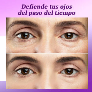 CREMA REVITALIZANTE PARA  CONTORNO DE OJOS (ANTI-OJERAS)